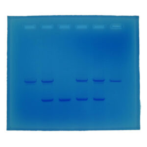 Cystic Fibrosis - Electrophoresis Education kit