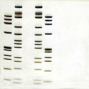 Tris-Borate-EDTA Gels (Gradient)