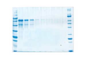 5X COOMASSIE Concentrate Protein Staining Solution, 1L