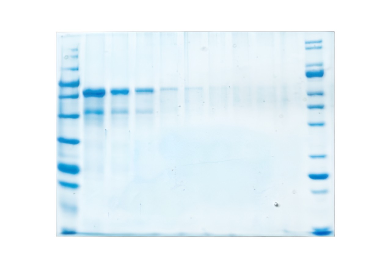 5X COOMASSIE Concentrate Protein Staining Solution, 1L